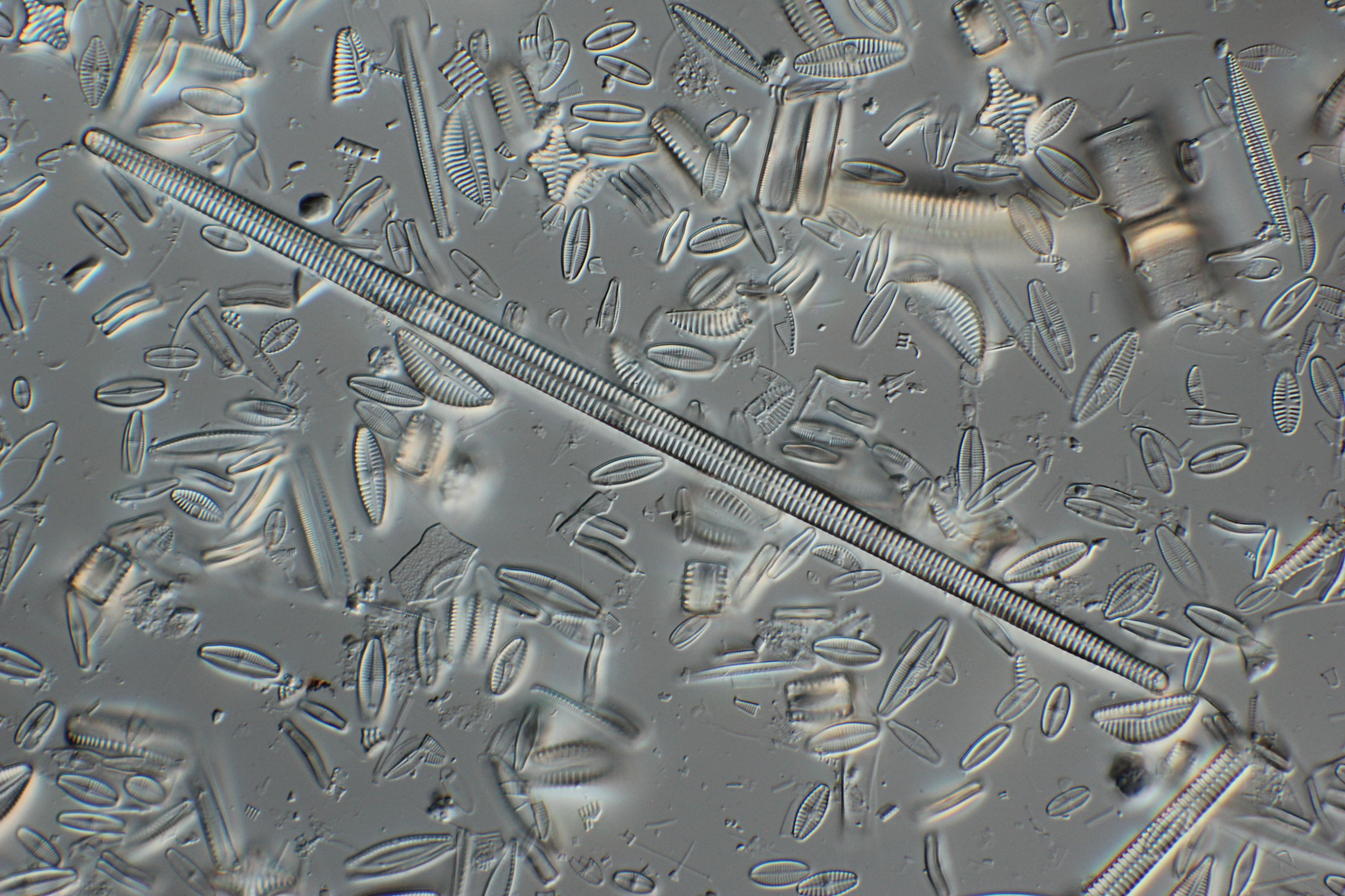 Variety of diatoms